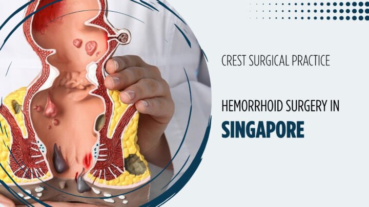 hemorrhoid surgery